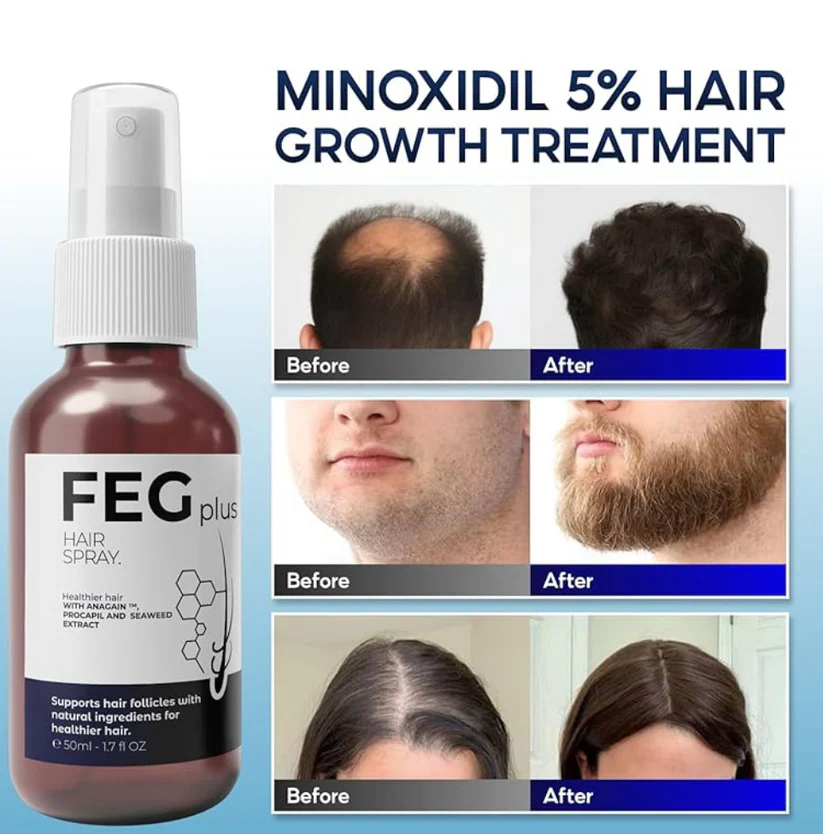 FEGPLUSHairGrowthSpray1.webp